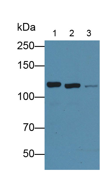 Monoclonal Antibody to Vinculin (VCL)