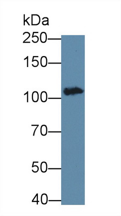 Monoclonal Antibody to Vinculin (VCL)