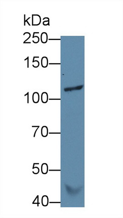 Monoclonal Antibody to Vinculin (VCL)