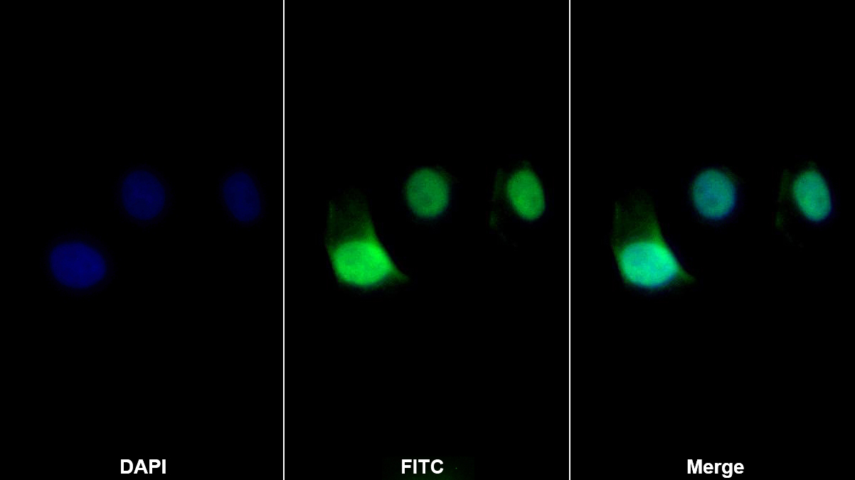 Monoclonal Antibody to Receptor Tyrosine Protein Kinase erbB-2 (ErbB2)