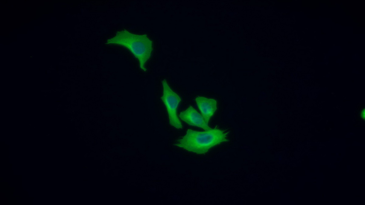 Monoclonal Antibody to Tubulin Beta (TUBb)