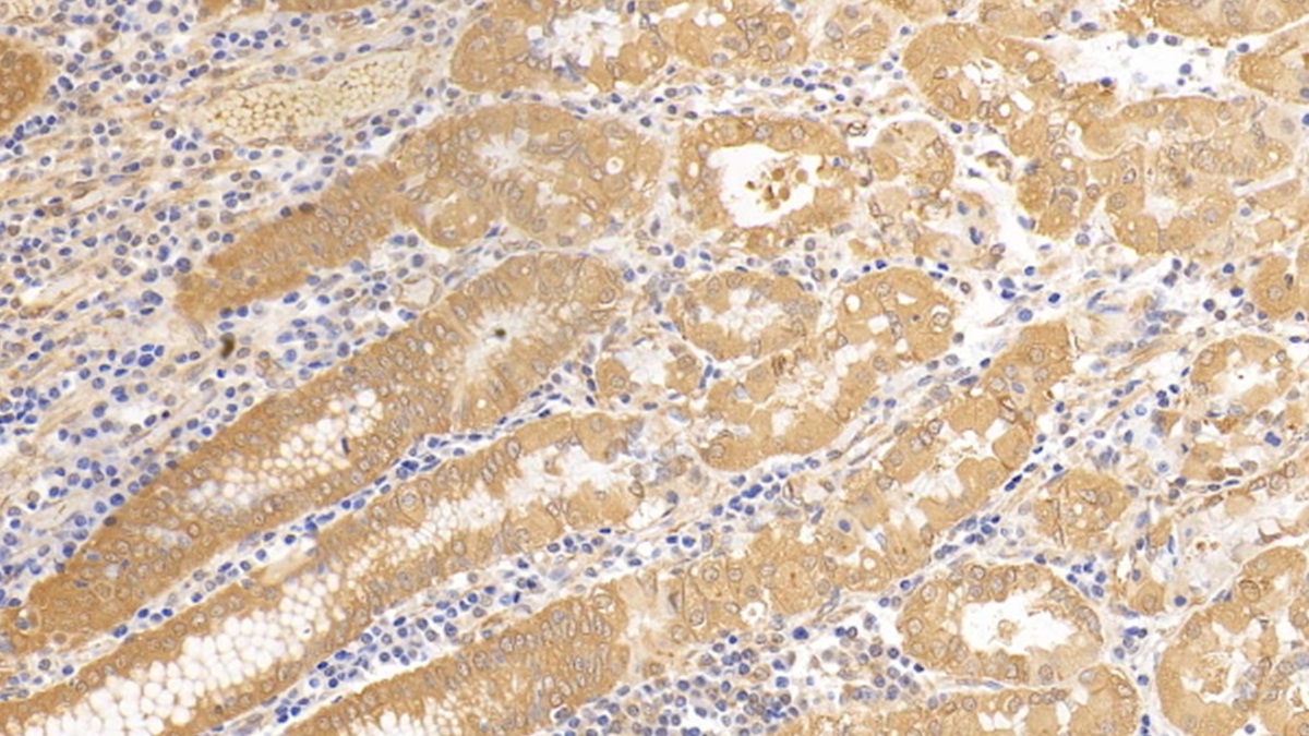 Monoclonal Antibody to Tubulin Beta (TUBb)