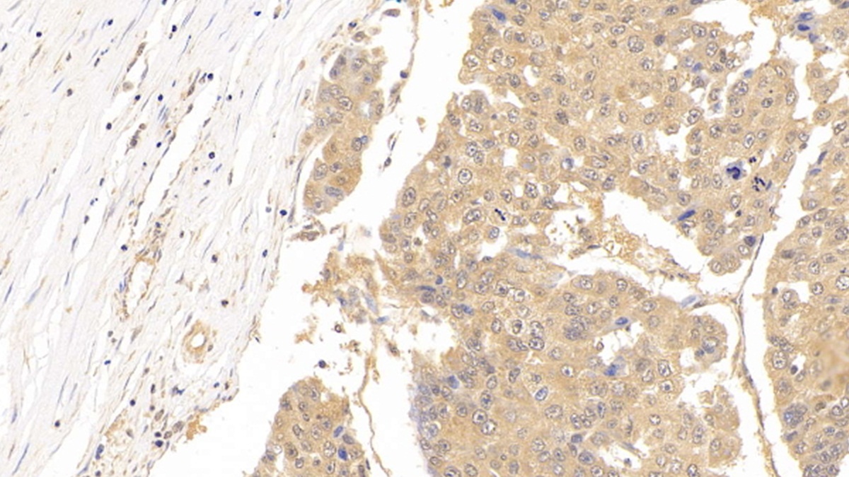 Monoclonal Antibody to Tubulin Beta (TUBb)