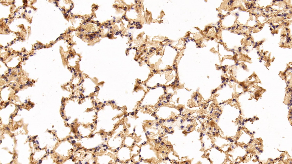 Monoclonal Antibody to Tubulin Beta (TUBb)
