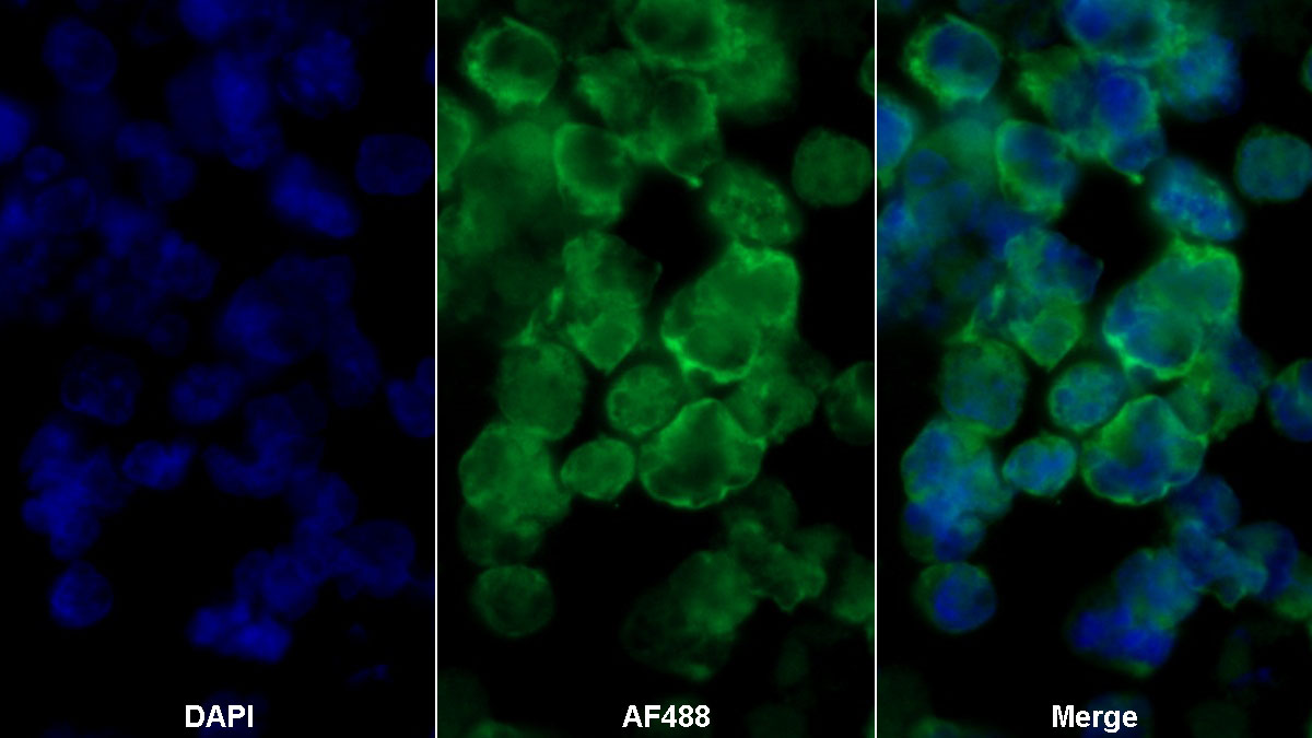 Monoclonal Antibody to Cluster Of Differentiation 19 (CD19)