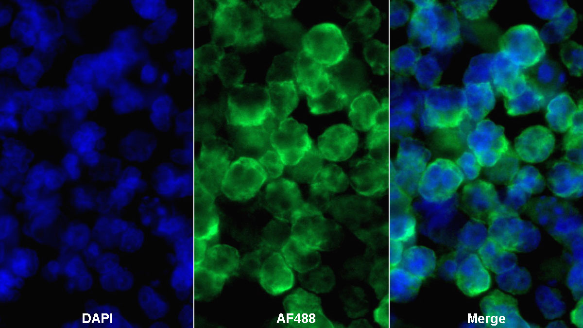 Monoclonal Antibody to Cluster Of Differentiation 19 (CD19)