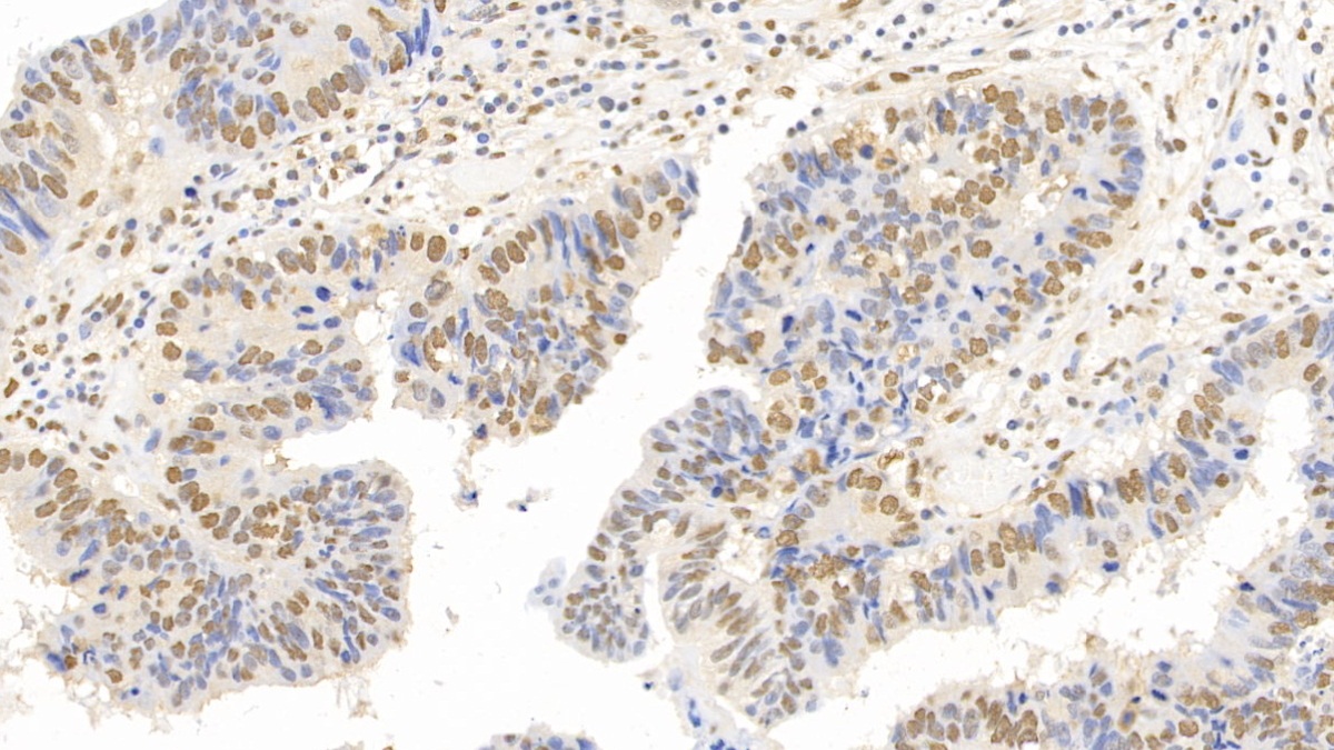 Monoclonal Antibody to Forkhead Box P3 (FOXP3)