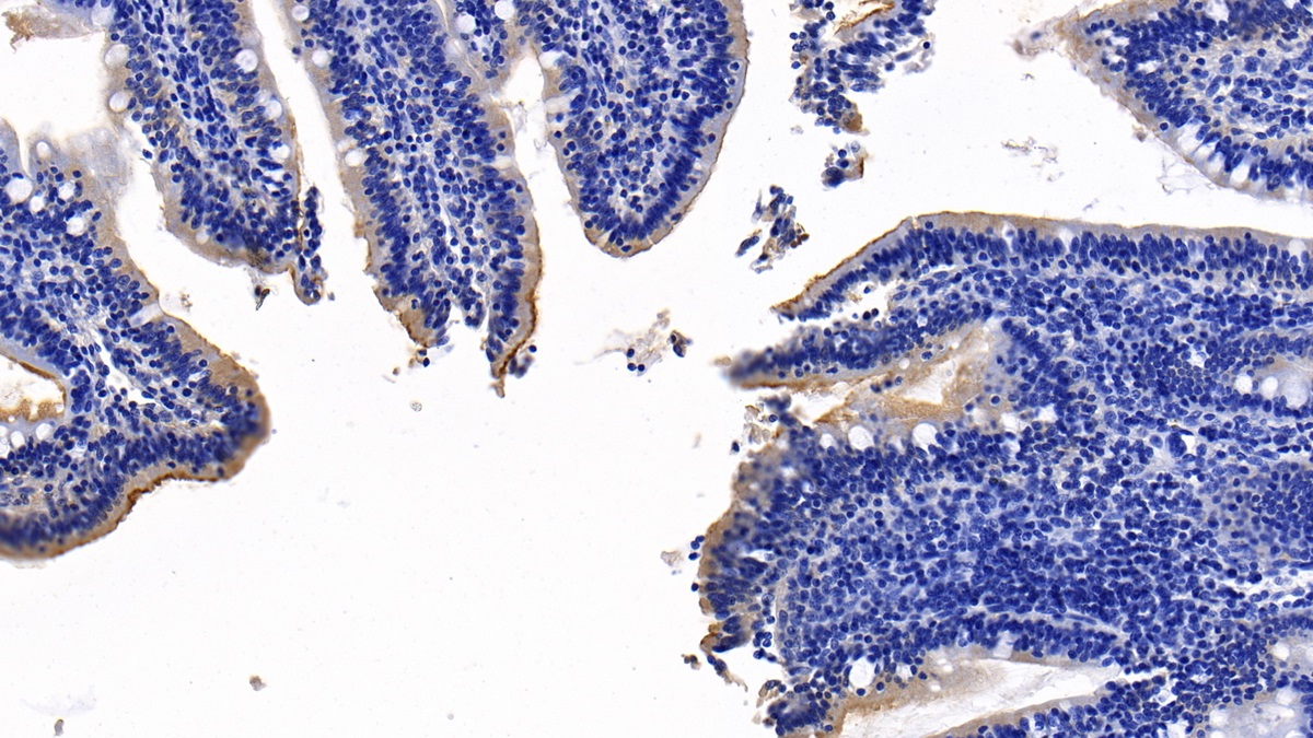 Monoclonal Antibody to Angiotensin I Converting Enzyme 2 (ACE2)