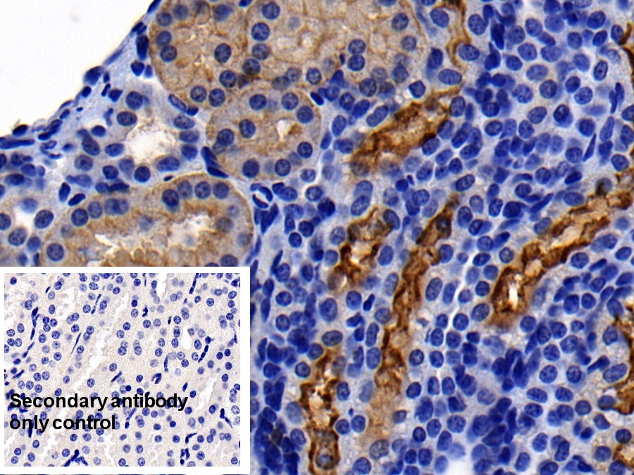 Monoclonal Antibody to Angiotensin I Converting Enzyme 2 (ACE2)