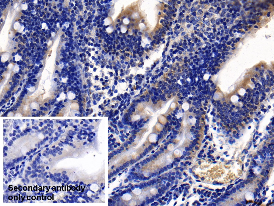 Monoclonal Antibody to Angiotensin I Converting Enzyme 2 (ACE2)