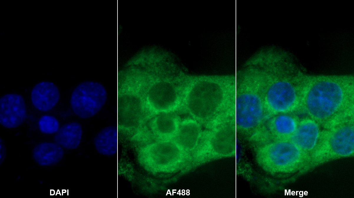 Monoclonal Antibody to Apolipoprotein C3 (APOC3)