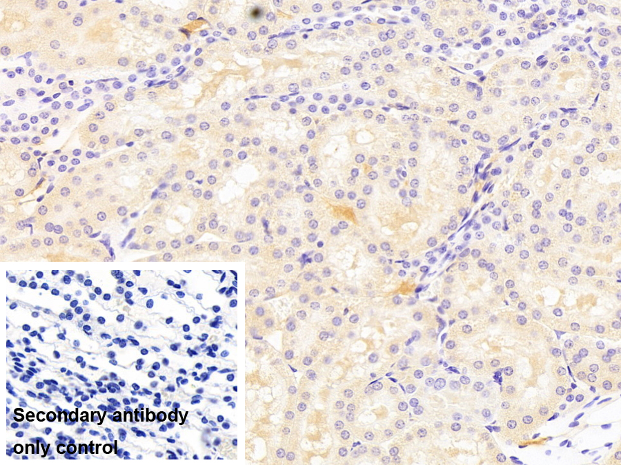 Monoclonal Antibody to Insulin Degrading Enzyme (IDE)
