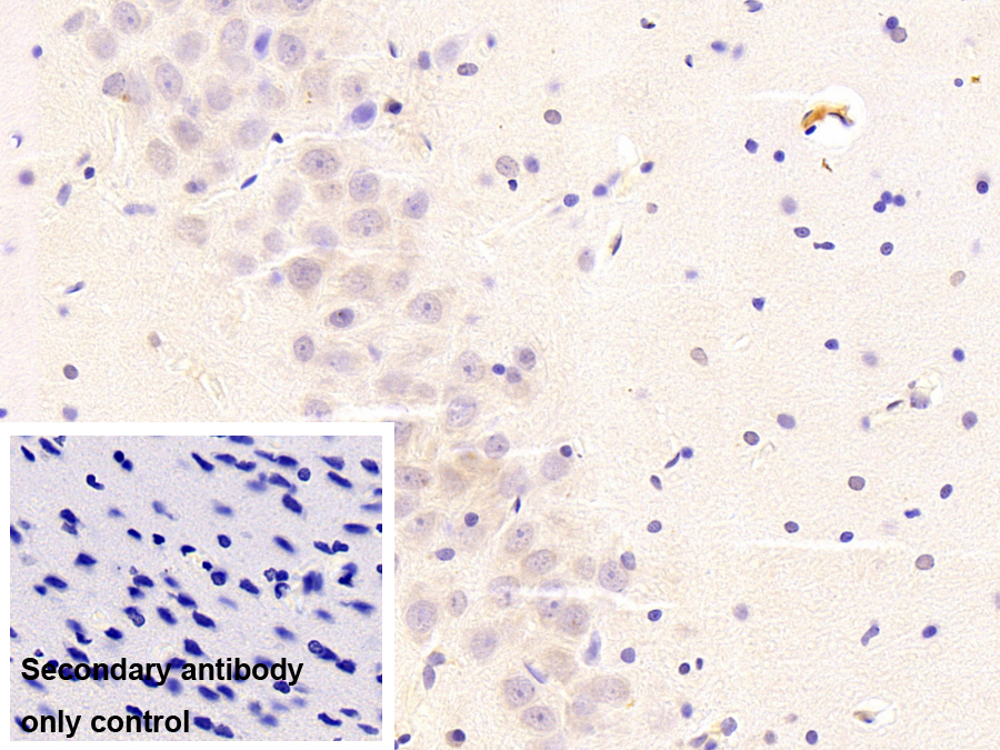 Monoclonal Antibody to Insulin Degrading Enzyme (IDE)