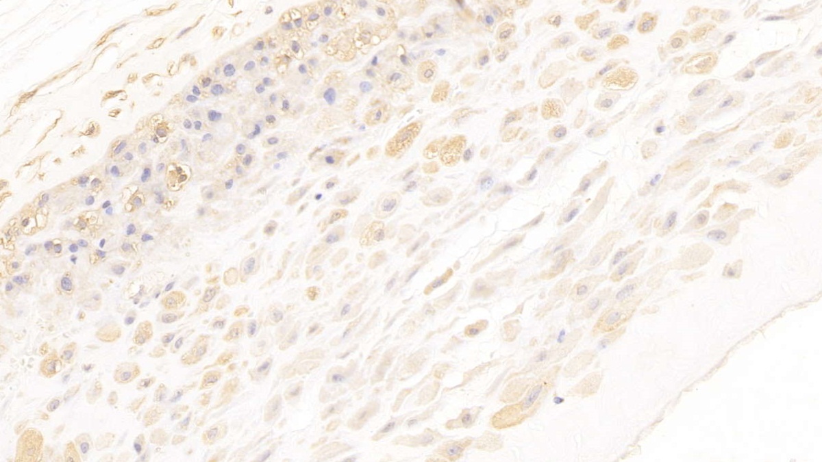 Monoclonal Antibody to Annexin A2 (ANXA2)