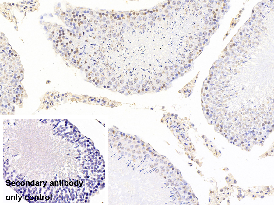 Monoclonal Antibody to Tar DNA Binding Protein 43kDa (TDP43)