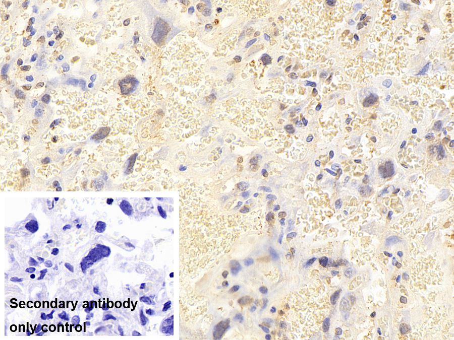 Monoclonal Antibody to Tar DNA Binding Protein 43kDa (TDP43)
