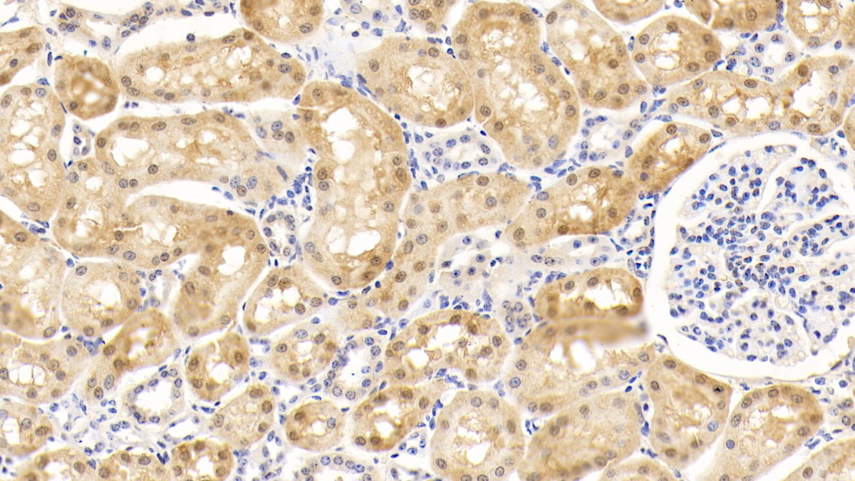 Monoclonal Antibody to Superoxide Dismutase 1 (SOD1)