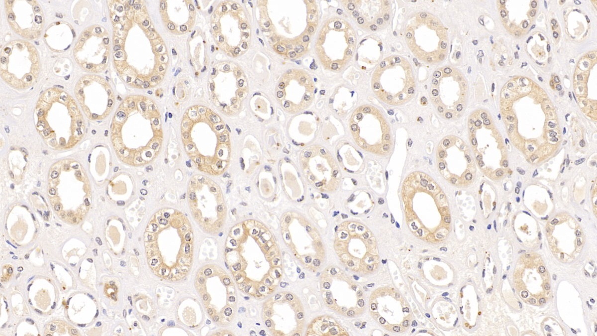 Monoclonal Antibody to Syndecan 1 (SDC1)