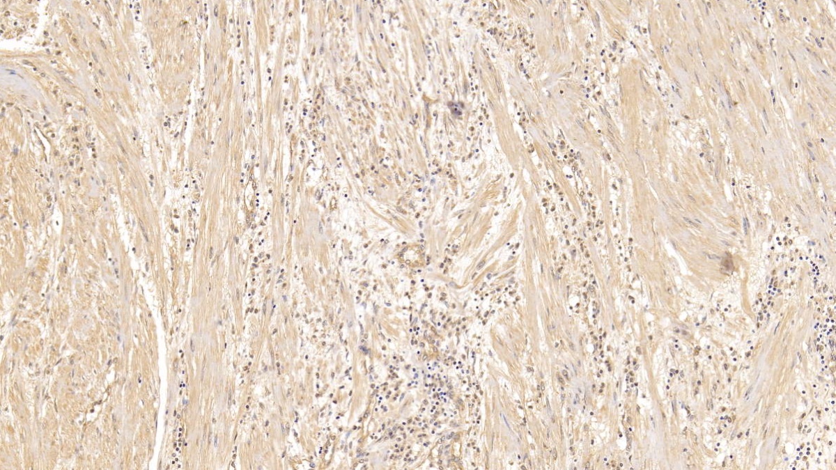 Monoclonal Antibody to Syndecan 1 (SDC1)