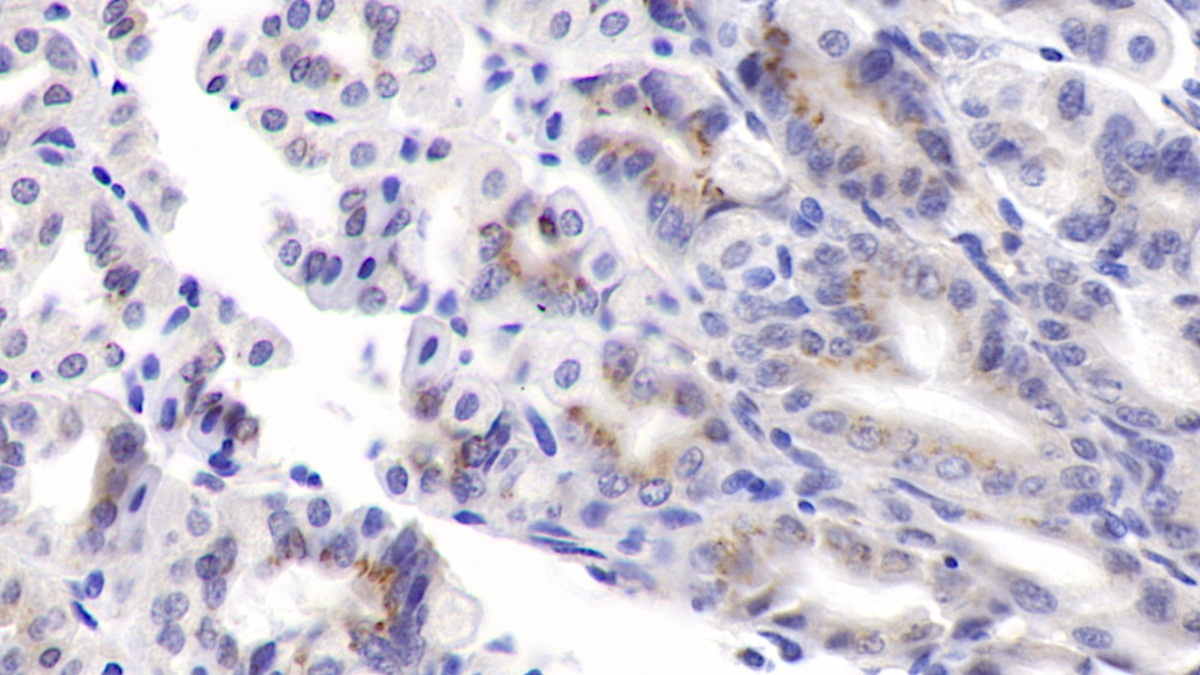 Monoclonal Antibody to Pigment Epithelium Derived Factor (PEDF)