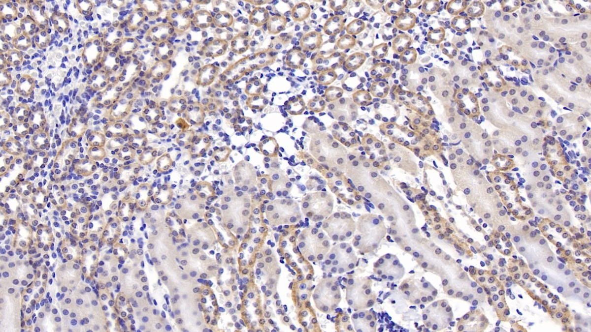 Monoclonal Antibody to Pigment Epithelium Derived Factor (PEDF)