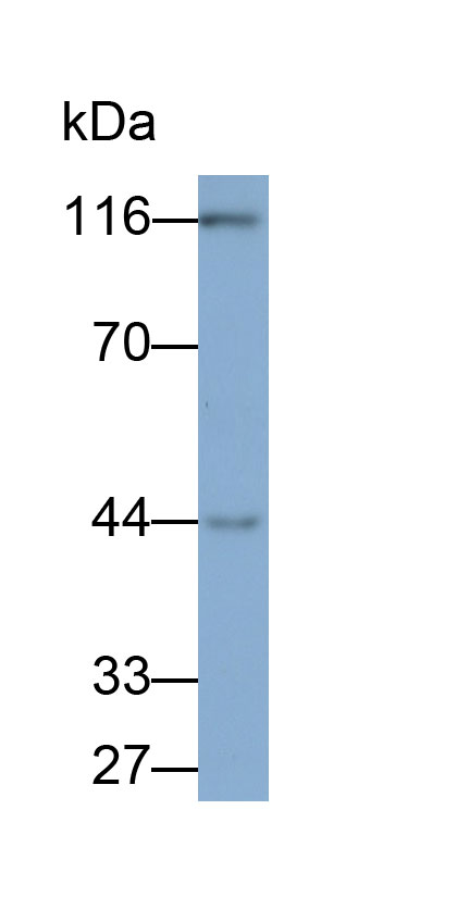 Monoclonal Antibody to Pigment Epithelium Derived Factor (PEDF)