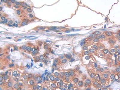 Monoclonal Antibody to Interleukin 33 (IL33)