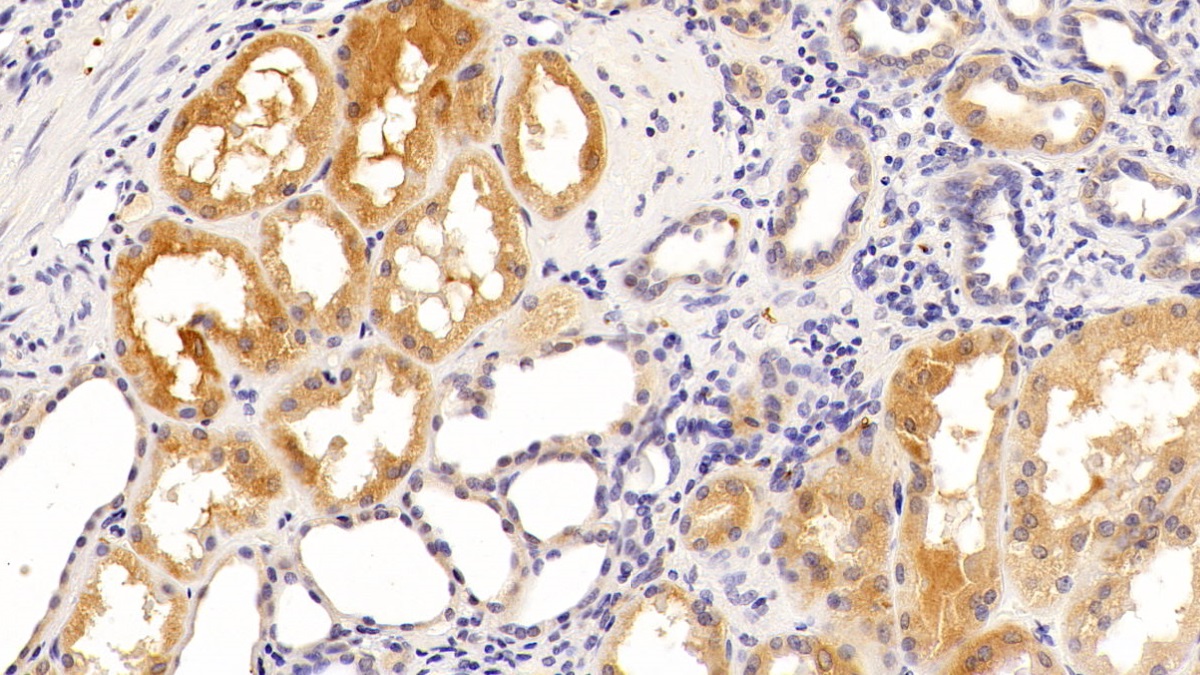 Monoclonal Antibody to Tau Protein (MAPT)