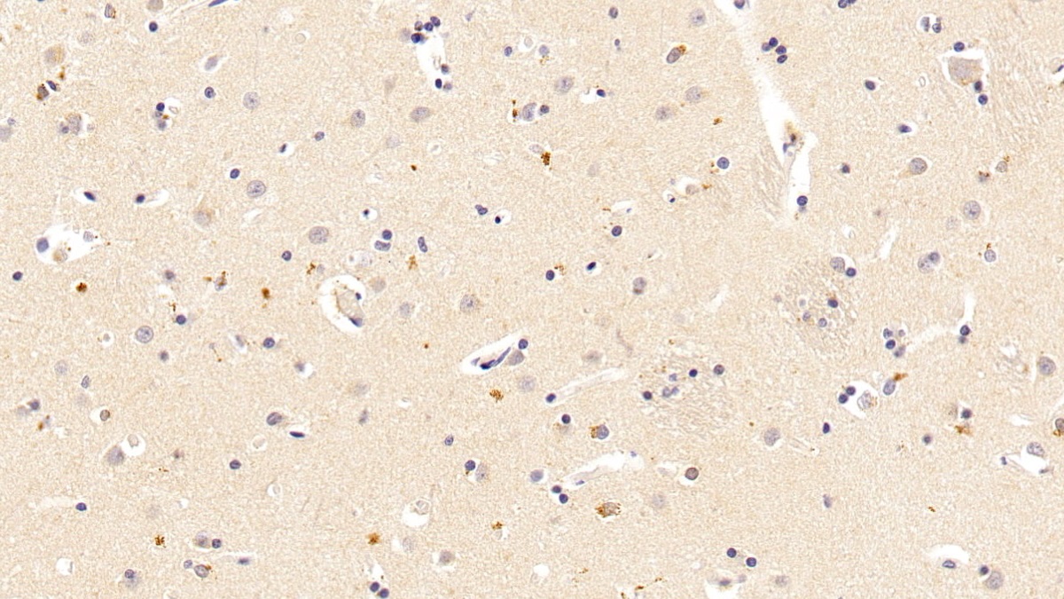 Monoclonal Antibody to Tau Protein (MAPT)