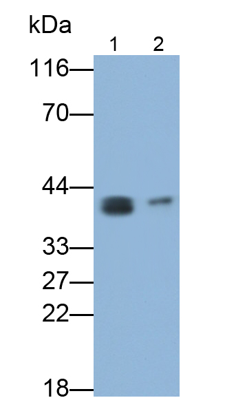 Monoclonal Antibody to Hemojuvelin (HJV)