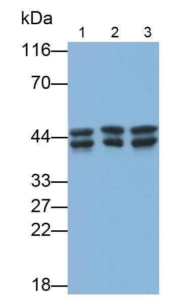 Monoclonal Antibody to Hemojuvelin (HJV)