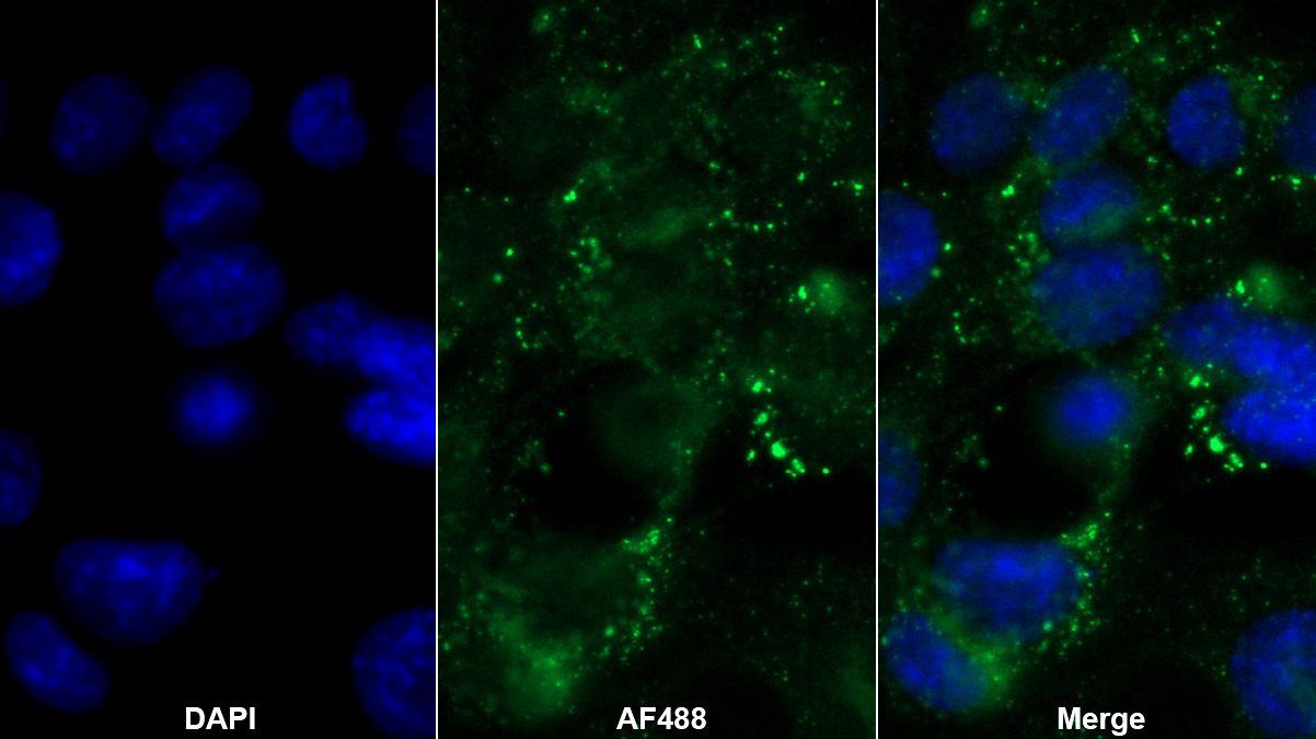 Monoclonal Antibody to Apolipoprotein A5 (APOA5)