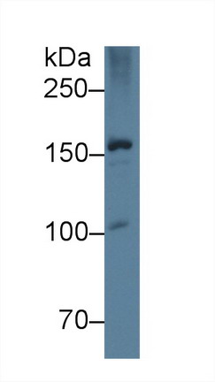 Monoclonal Antibody to Apolipoprotein B (APOB)