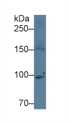 Monoclonal Antibody to Apolipoprotein B (APOB)