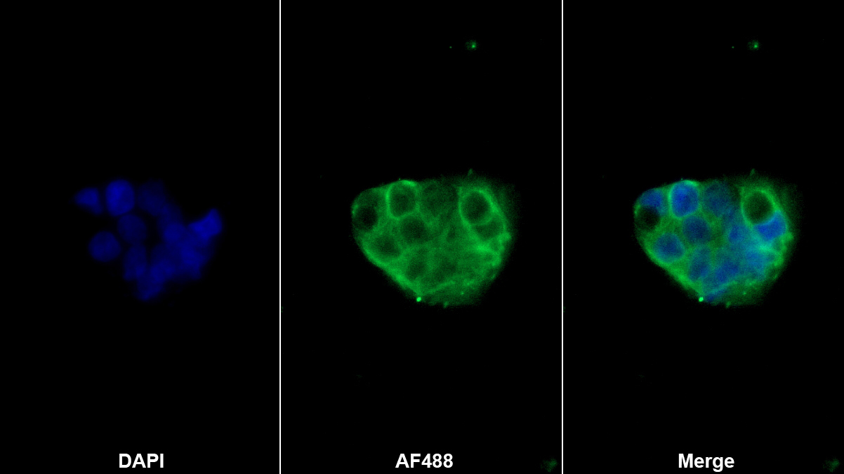 Monoclonal Antibody to Apolipoprotein B (APOB)