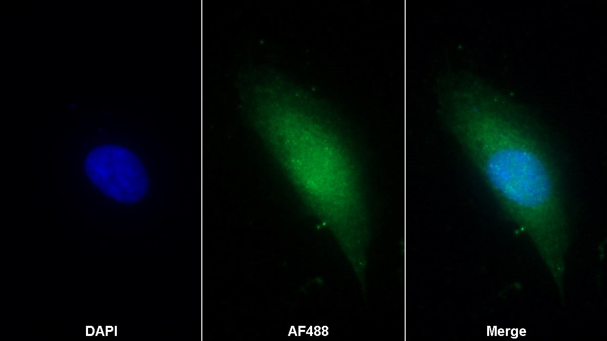 Monoclonal Antibody to S100 Calcium Binding Protein A2 (S100A2)