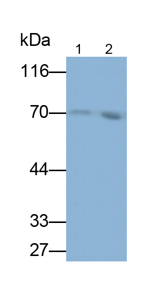 Monoclonal Antibody to Serpin A10 (SERPINA10)