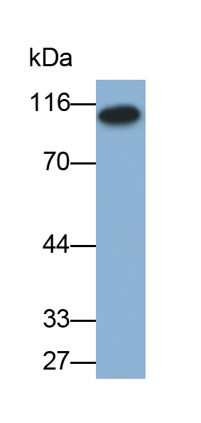 Monoclonal Antibody to Complement Factor B (CFB)