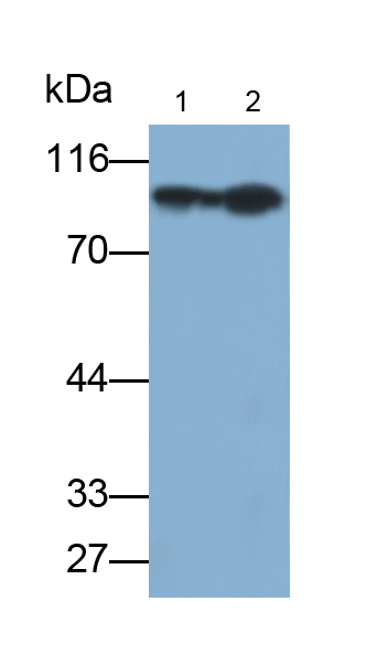 Monoclonal Antibody to Complement Factor B (CFB)