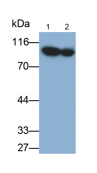 Monoclonal Antibody to Complement Factor B (CFB)