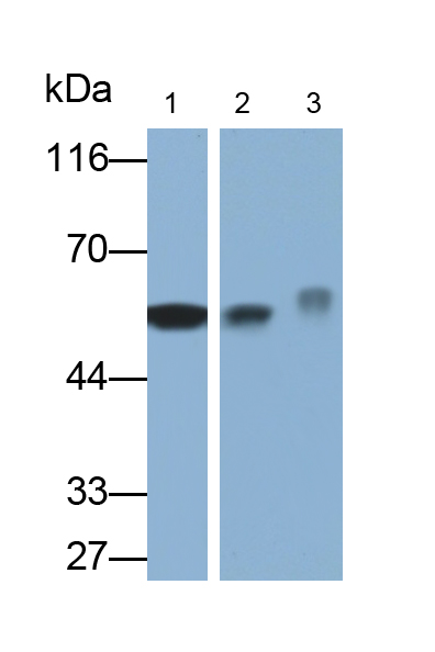 Monoclonal Antibody to Aldehyde Dehydrogenase, Mitochondrial (ALDH2)