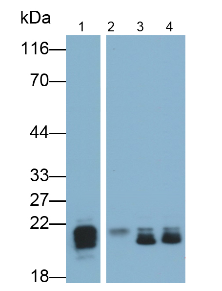 Monoclonal Antibody to O-6-Methylguanine DNA Methyltransferase (MGMT)