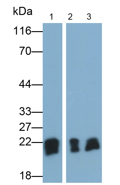 Monoclonal Antibody to O-6-Methylguanine DNA Methyltransferase (MGMT)