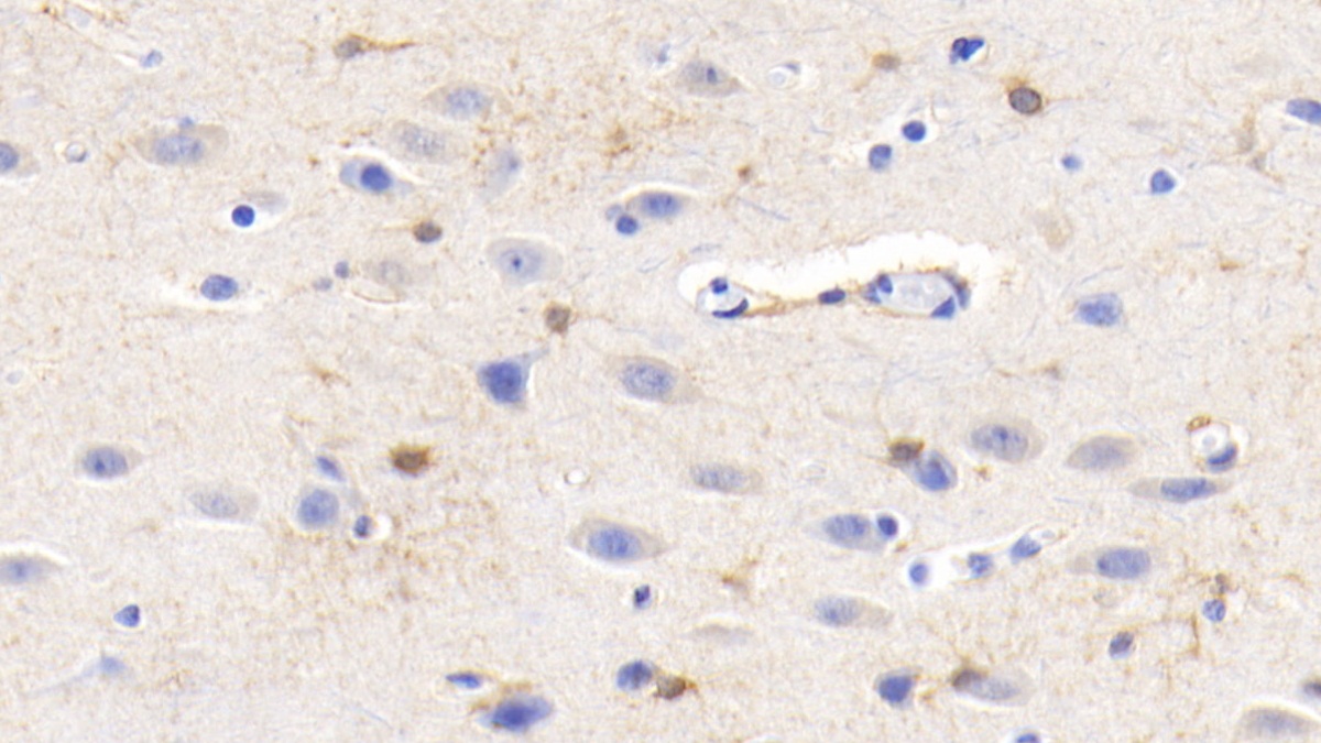 Monoclonal Antibody to Creatine Kinase B (CK-BB)