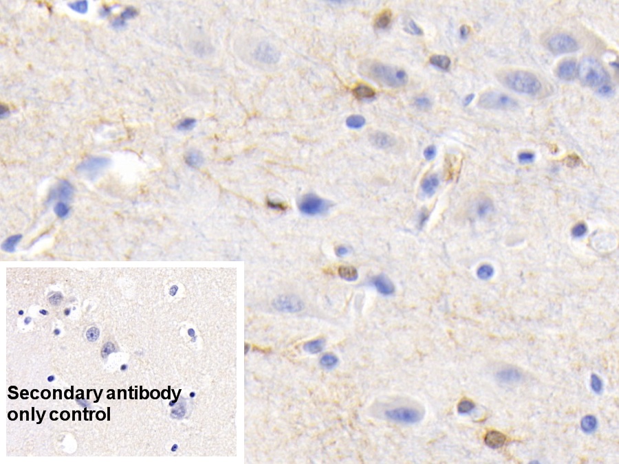 Monoclonal Antibody to Creatine Kinase B (CK-BB)