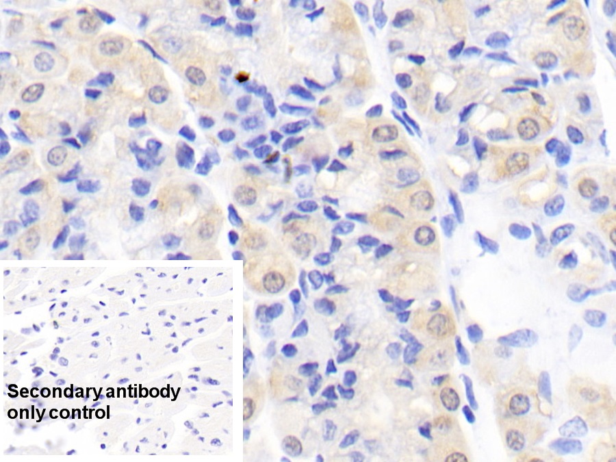 Monoclonal Antibody to Creatine Kinase B (CK-BB)