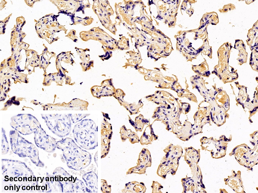 Monoclonal Antibody to Transferrin (TF)