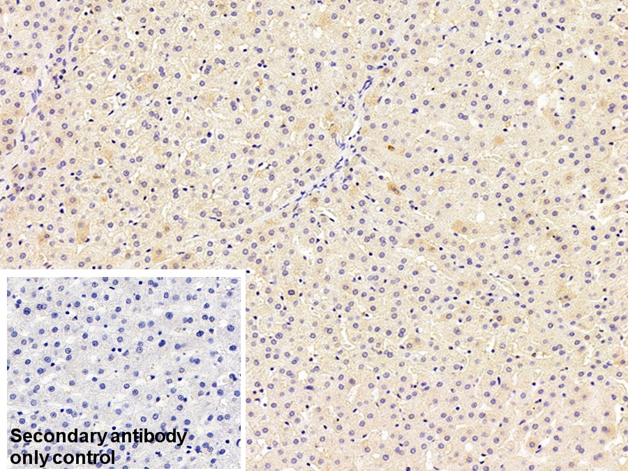 Monoclonal Antibody to Transferrin (TF)