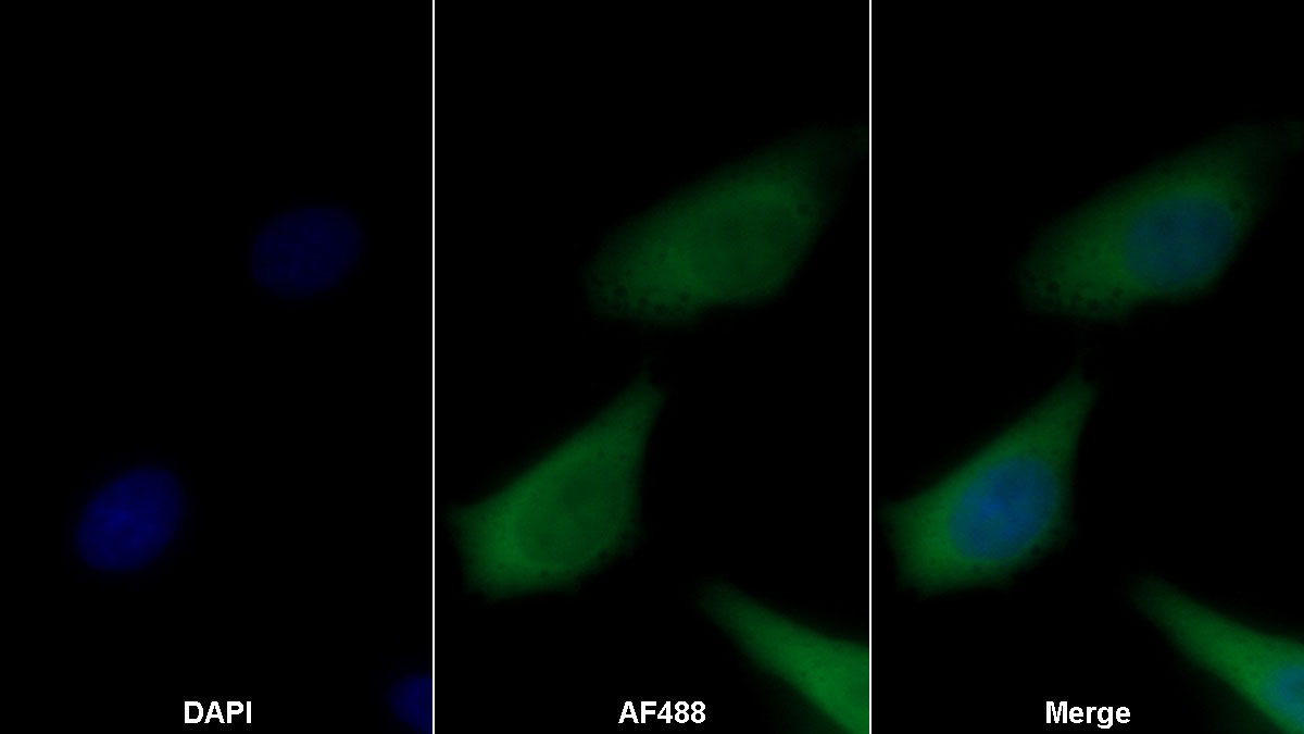 Monoclonal Antibody to Transferrin (TF)