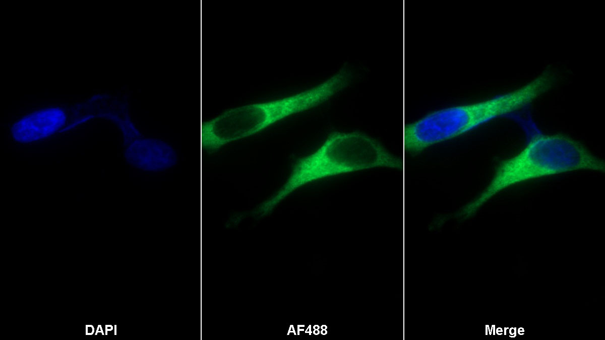 Monoclonal Antibody to Transferrin (TF)